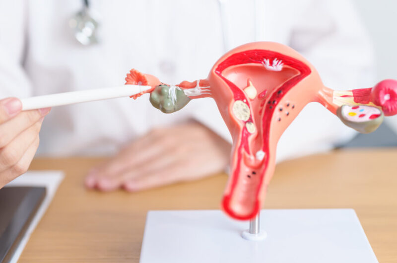 Gynecology